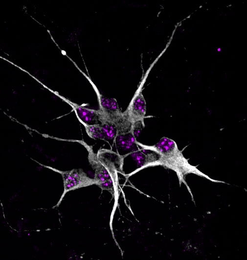 Induced pluripotent stem cells imaged on the Opera Phenix high-content screening system.