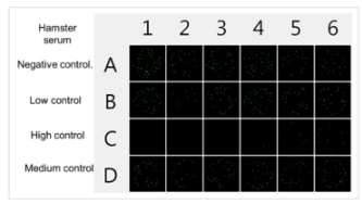 Automated focus reduction neutralization test using GFP-expressing RSV-2