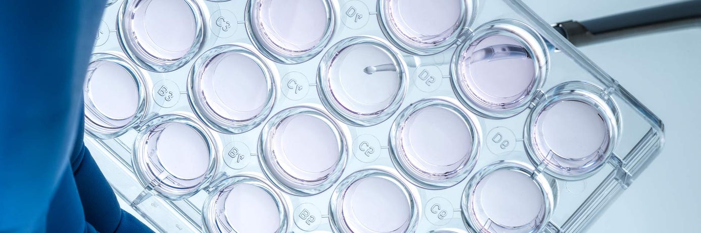 Automated imaging and analysis of patient-derived organoids identifies effective personalized therapies.