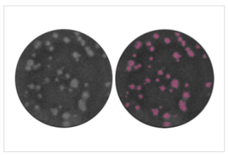 img-automated-imaging-and-detection-of-cytolytic-plaques-1.PNG