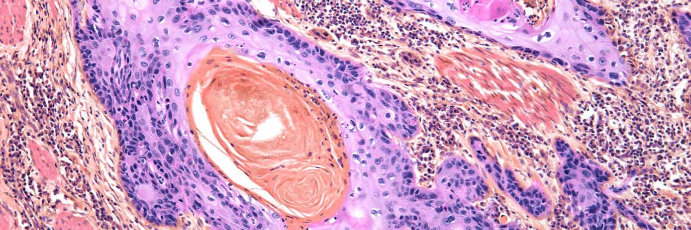 img-biomarker-in-cancer1920x640