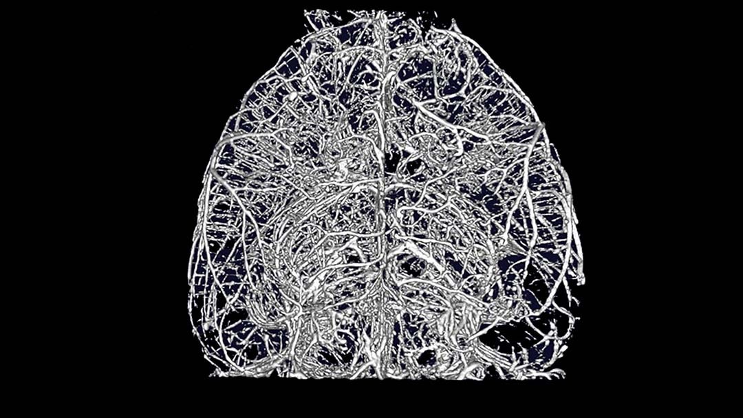 Mouse brain showing blood vessels