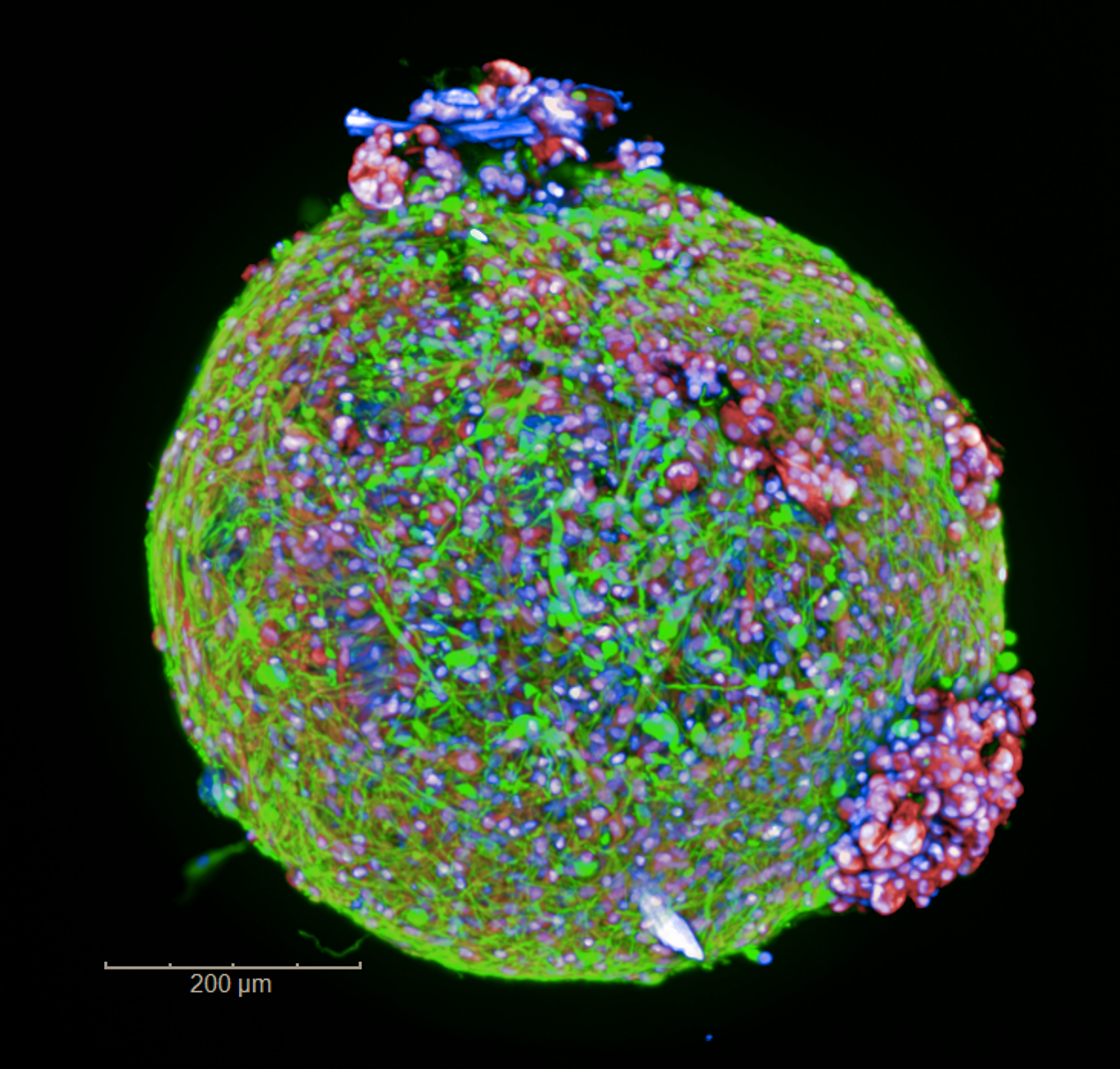 "Organoids from pediatric brain tumor imaged on the Opera Phenix Plus high-content screening system. "