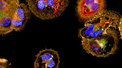 img-cell-imaging-analysis512x288