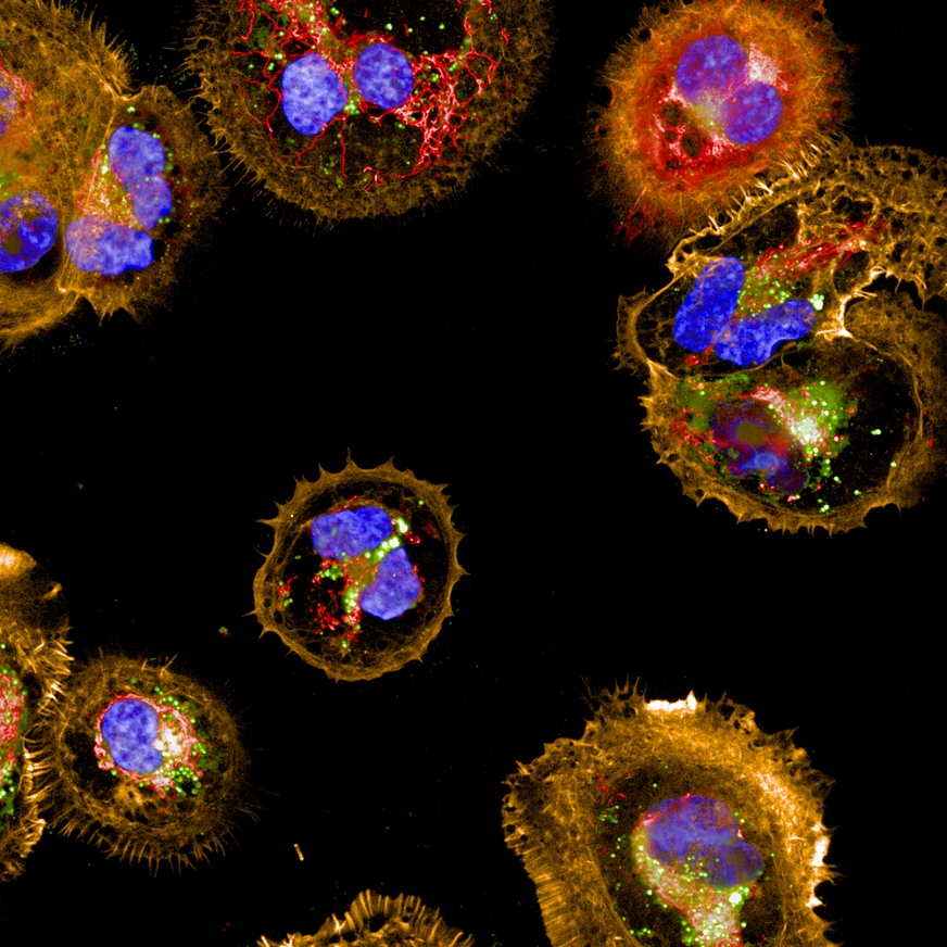 img-cell-imaging-analysis872x872