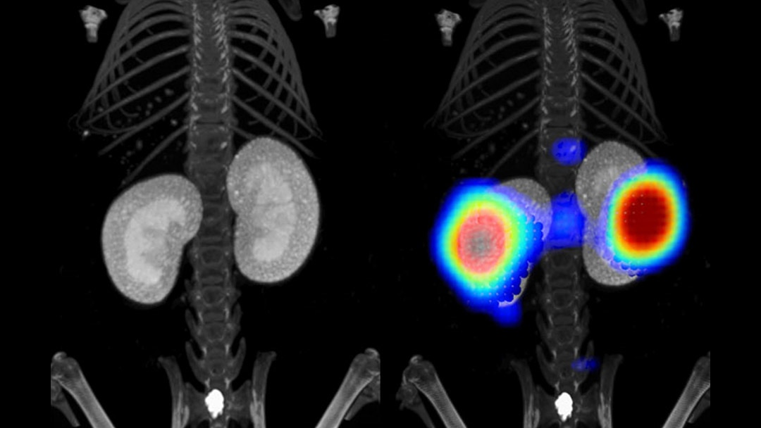 Contrast enhanced microCT and fluorescence tomography