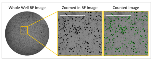 Cytomegalovirus neutralization assay using brightfield-2