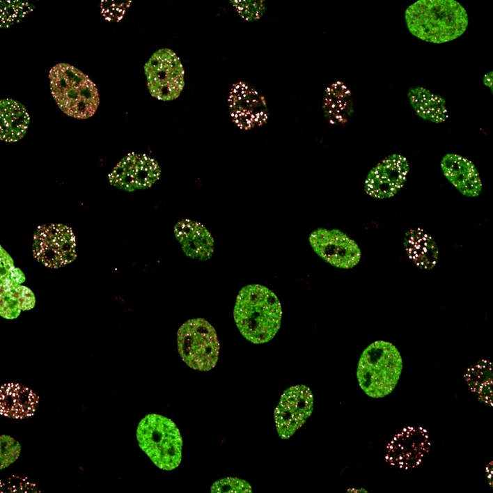 HeLa cells imaged on the Opera Phenix Plus high-content imaging system.