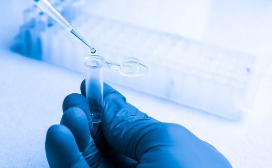 Diagnostic Microbiology and Infectious Diseases in 2026: Why Front-End Automation Decides Who Survives the Crush