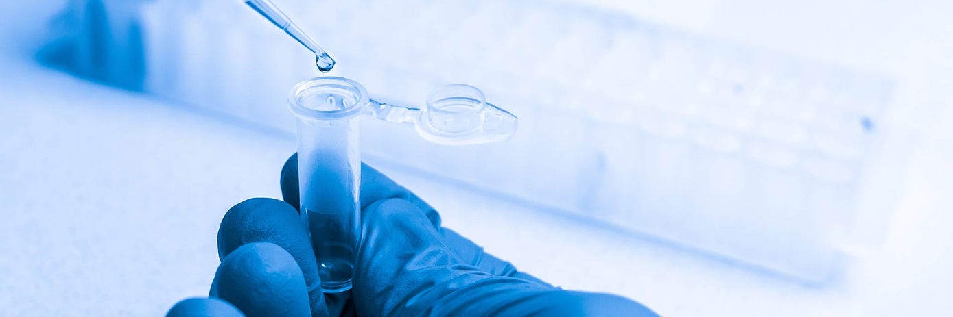 Diagnostic Microbiology and Infectious Diseases in 2026: Why Front-End Automation Decides Who Survives the Crush