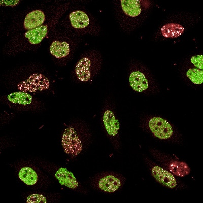 Cell image generated with the PhenoVue DNA damage response staining kit