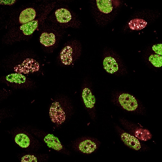 Cell image generated with the PhenoVue DNA damage response staining kit