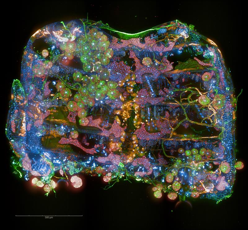 Drosophila abdomen imaged on the Operetta CLS high-content analysis system.