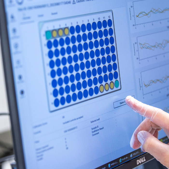 Close-up of a computer screen showing newborn screening results within the EASI analysis software.
