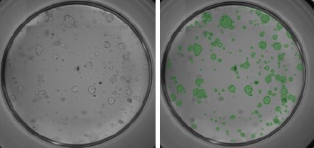 Mouse pancreatic organoids plated-24 well plate