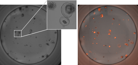 RFP-labeled mouse pancreatic organoids plated