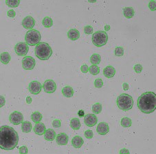 Embryoid bodies of Brightfield image-1