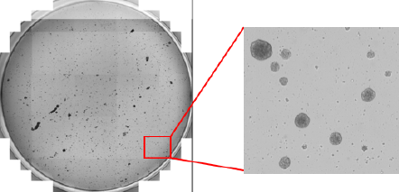 Whole-well image of embryoid bodies 