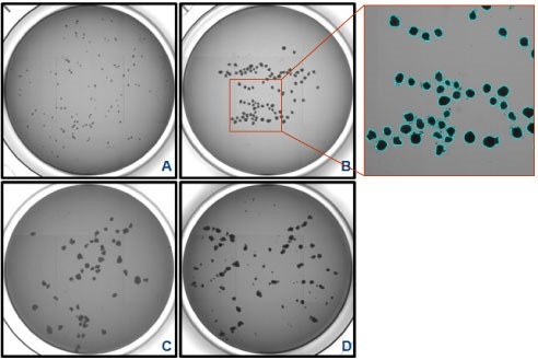 Embryoid Body Formation