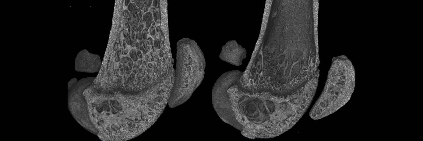femur control vs ovex