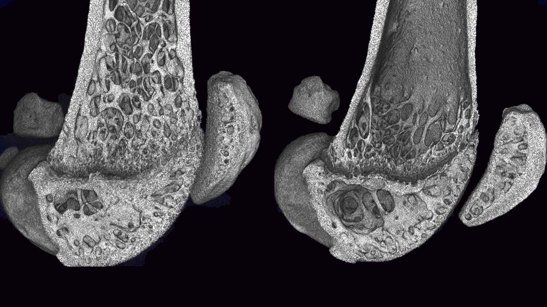 Measuring bone loss in 2 osteoporosis mouse models