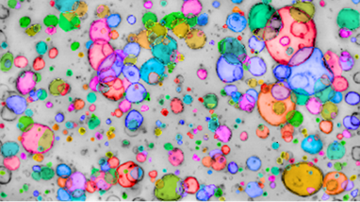 find organoids thumbnail