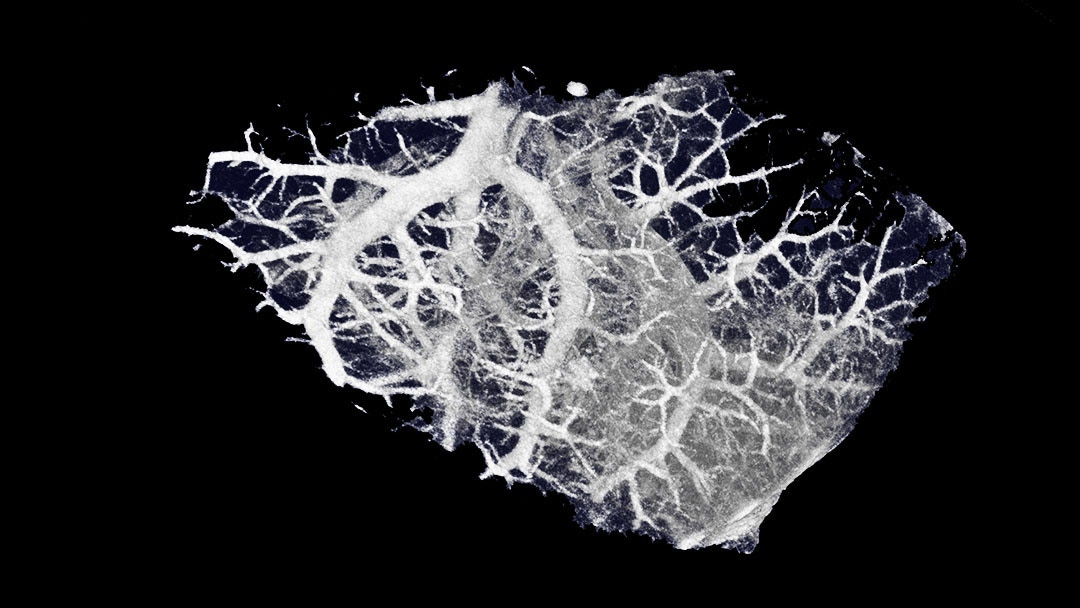Mouse lung