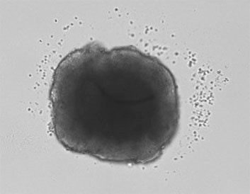 growth inhibition spheroid at normoxia