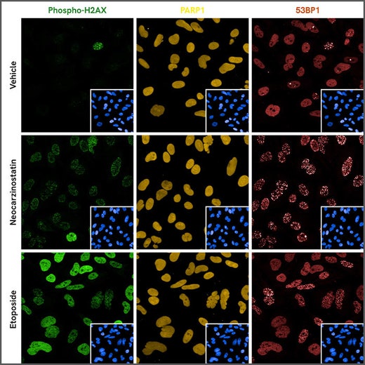 HeLa cells stained with the PhenoVue DNA damage response staining kit (PDDR11) and anti-PARP1 antibody.