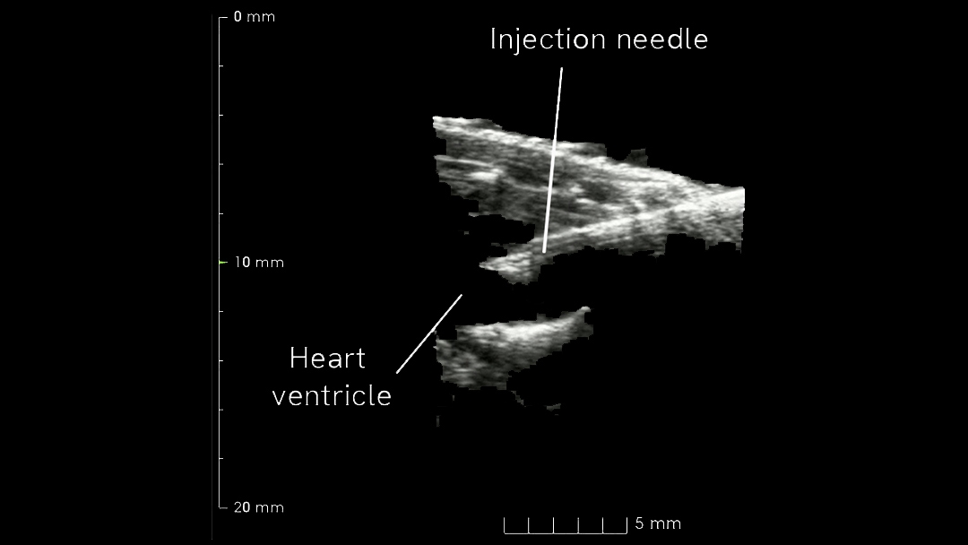 Image-guided injections using the VivoJect™ system