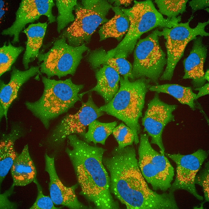 HeLa cells imaged on the Operetta CLS high-content analysis system.