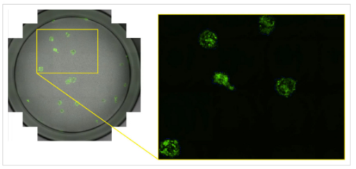 High-throughput counting of GFP-expressing influenza viral foci-1