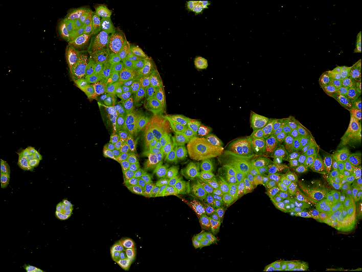 HPAF-II cells imaged on the Operetta CLS  high-content analysis system.