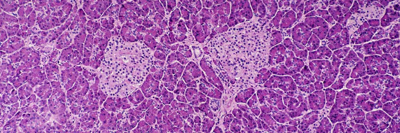 HTRF TAZ- deficiency barth syndrome