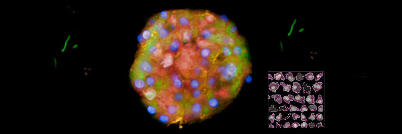 Image analysis strategies for 3D Cell Painting assays featuring primary human hepatocyte spheroids hero