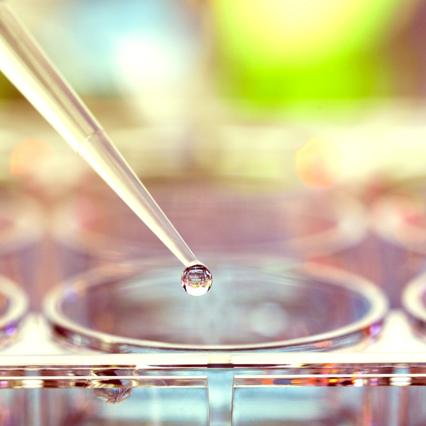 Immunoassays solutions