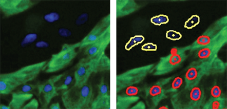 Immunostaining for Differentiation