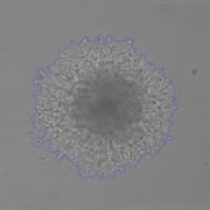 Quantify Invasion into Matrigel Brightfield Identified Spheroid 48hr