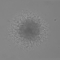 Quantify Invasion into Matrigel Brightfield Spheroid 48hr