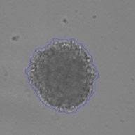 Quantify Invasion into Matrigel Brightfield Identified Spheroid 