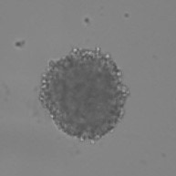 Quantify Invasion into Matrigel Brightfield Spheroid 1