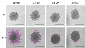 Quantify Invasion into Matrigel Brightfield Spheroid Image