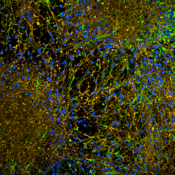Human iPSC-derived neurons imaged on the Opera Phenix Plus high-content screening system.