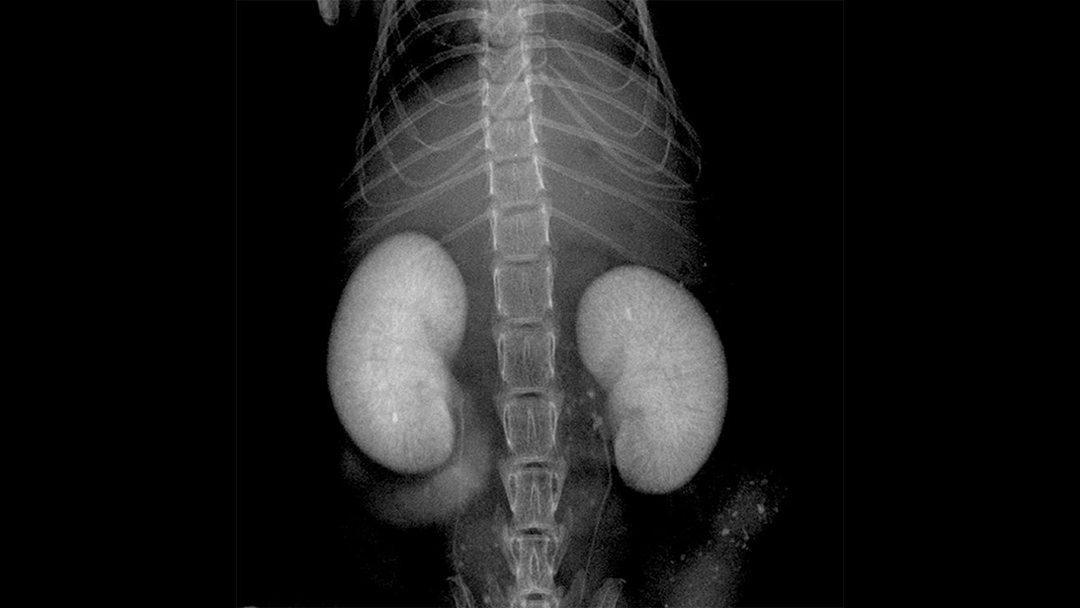 High resolution x-ray imaging