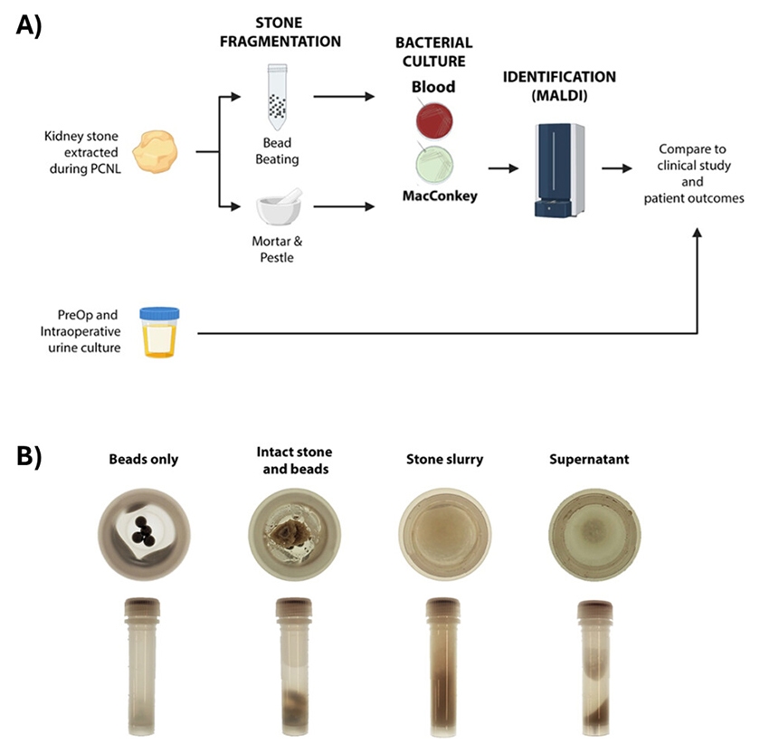 Publication figure and graphical abstract with visual of homogenized kidney stones after bead-beating