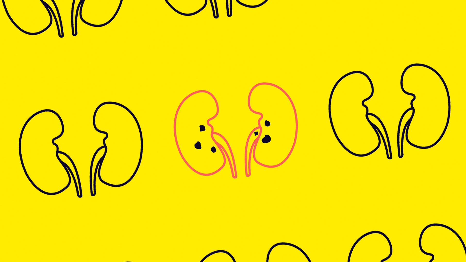 Kidney stone disease bead mill homogenizer vs mortar pestle blog