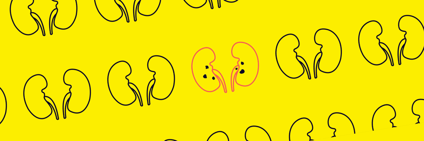 Kidney stone disease bead mill homogenizer vs mortar pestle blog