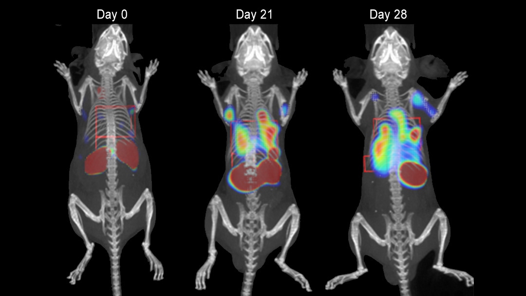 Longitudinal imaging of tumor
