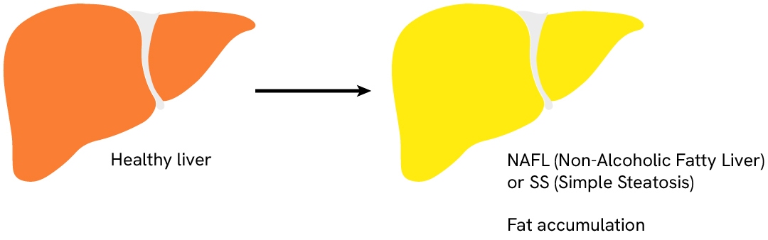 mash masld webpage illustration 2