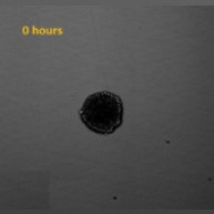 Measure Migration onto Extracellular Matrix Spheroid Brightfield image-1